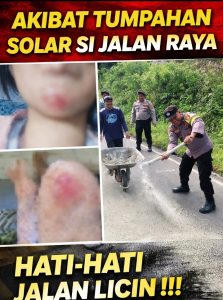 Tumpahan Solar di Tanjakan Giham Sukamaju Sebabkan Kecelakaan, Warga Giham Alami Luka !